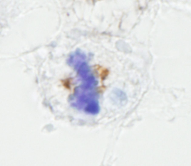 NUMA Antibody in Immunohistochemistry (IHC)