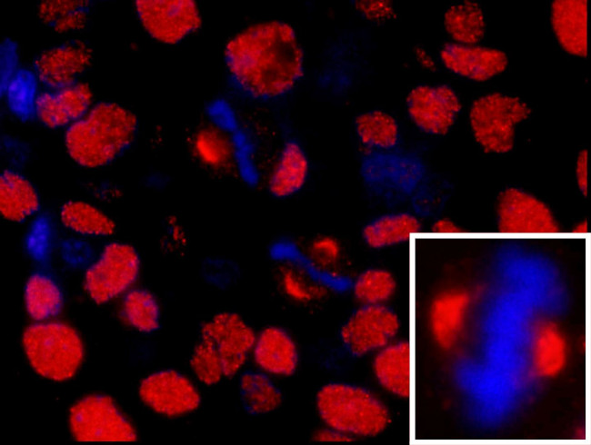 NUMA Antibody in Immunohistochemistry (IHC)