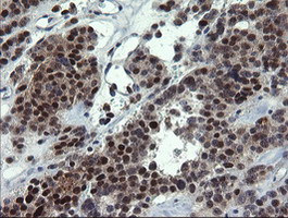 NUMB Antibody in Immunohistochemistry (Paraffin) (IHC (P))