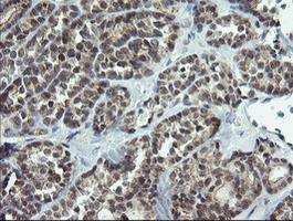 NUMB Antibody in Immunohistochemistry (Paraffin) (IHC (P))