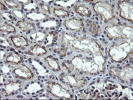 NUMB Antibody in Immunohistochemistry (Paraffin) (IHC (P))