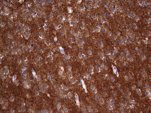 NUMB Antibody in Immunohistochemistry (Paraffin) (IHC (P))