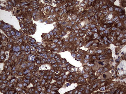 NUMB Antibody in Immunohistochemistry (Paraffin) (IHC (P))