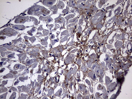 NUMB Antibody in Immunohistochemistry (Paraffin) (IHC (P))