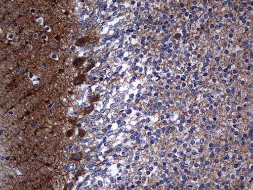 NUMB Antibody in Immunohistochemistry (Paraffin) (IHC (P))