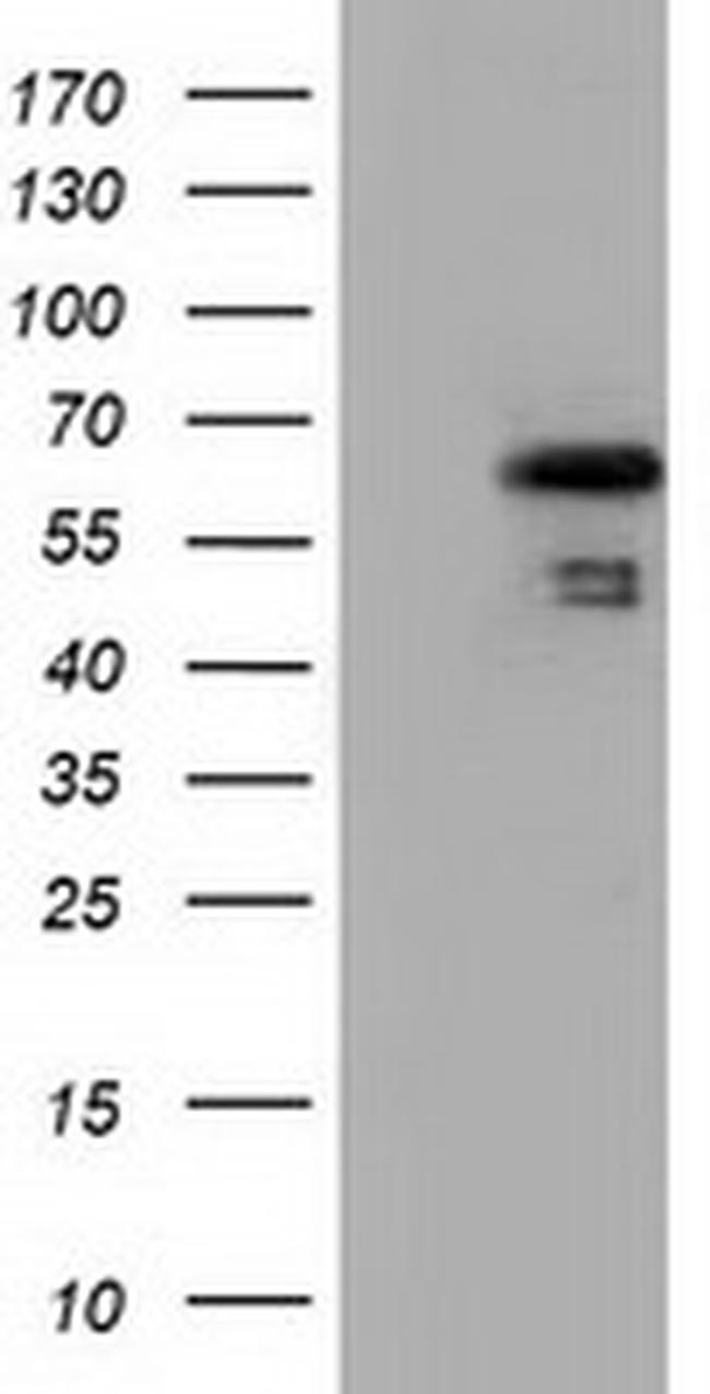 NUMB Antibody in Western Blot (WB)