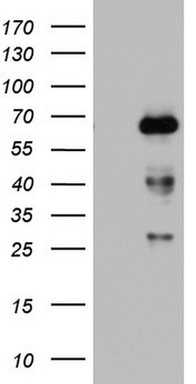 NUMB Antibody in Western Blot (WB)