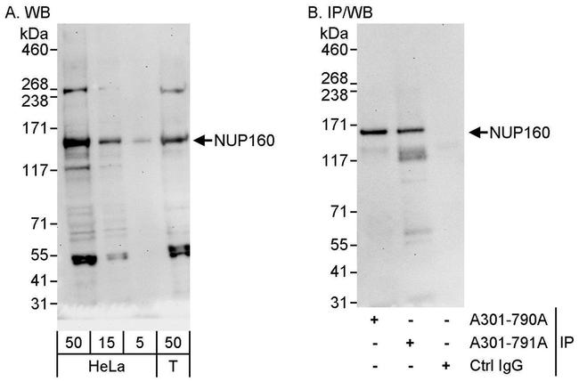 NUP160 Antibody in Western Blot (WB)