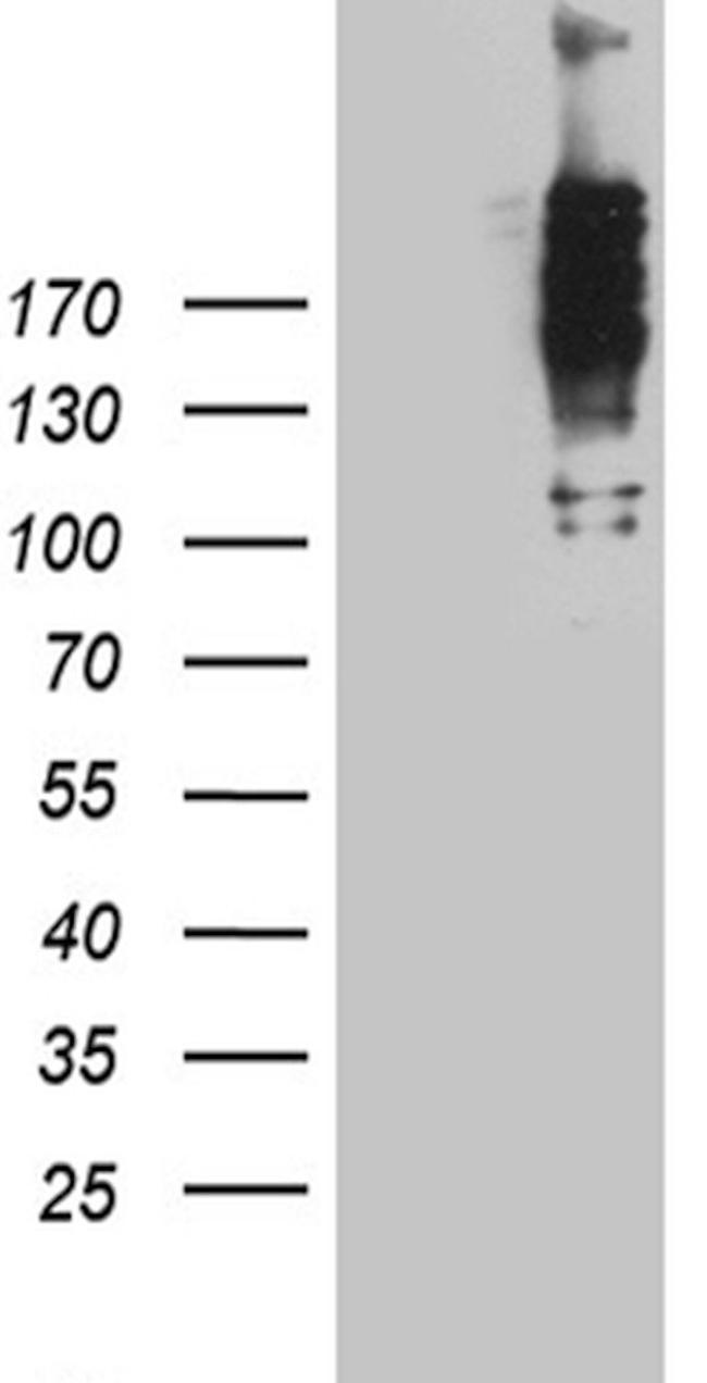 NUP214 Antibody in Western Blot (WB)