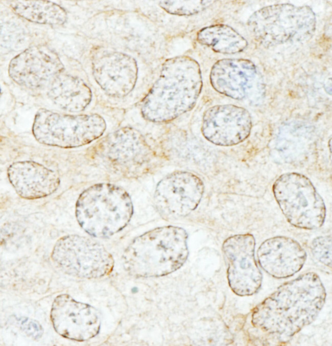 NUP50 Antibody in Immunohistochemistry (IHC)