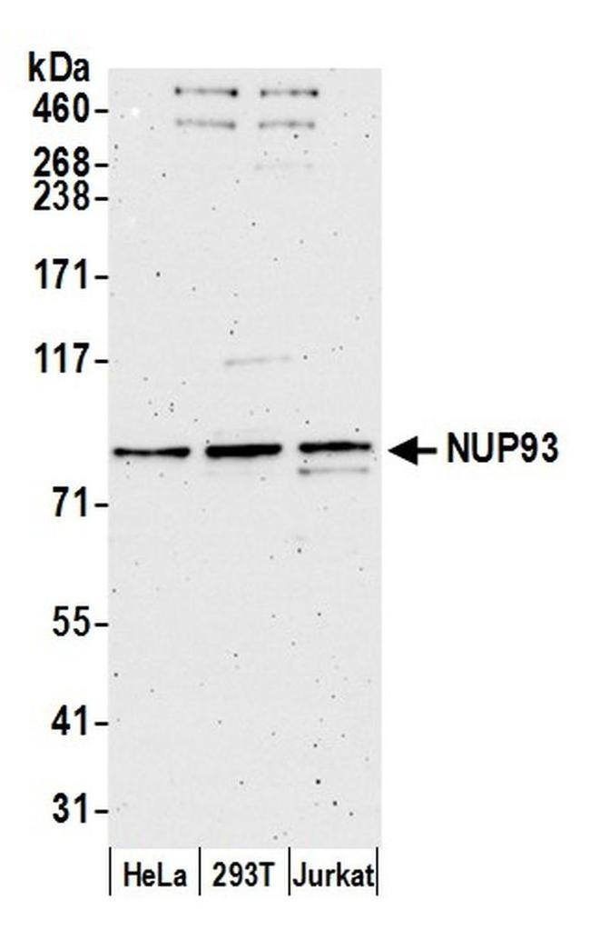 NUP93 Antibody in Western Blot (WB)