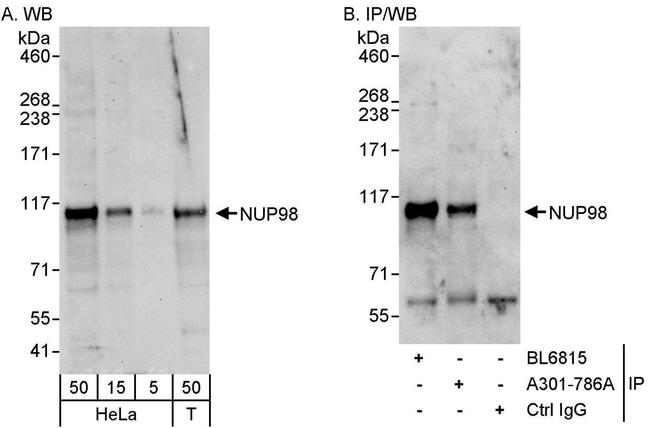 NUP98 Antibody in Western Blot (WB)