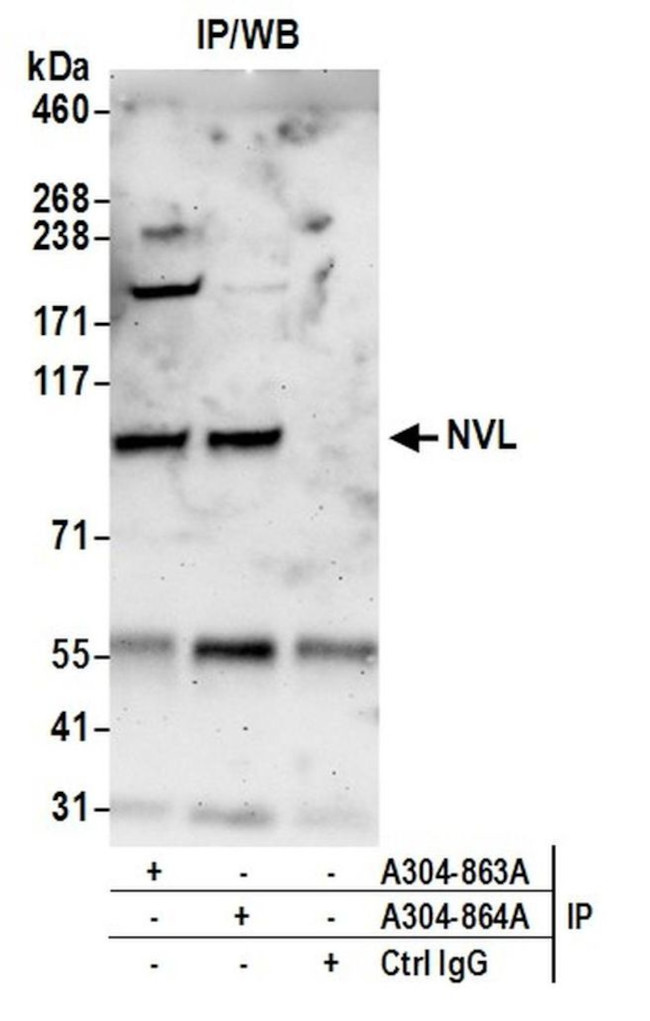 NVL Antibody in Immunoprecipitation (IP)