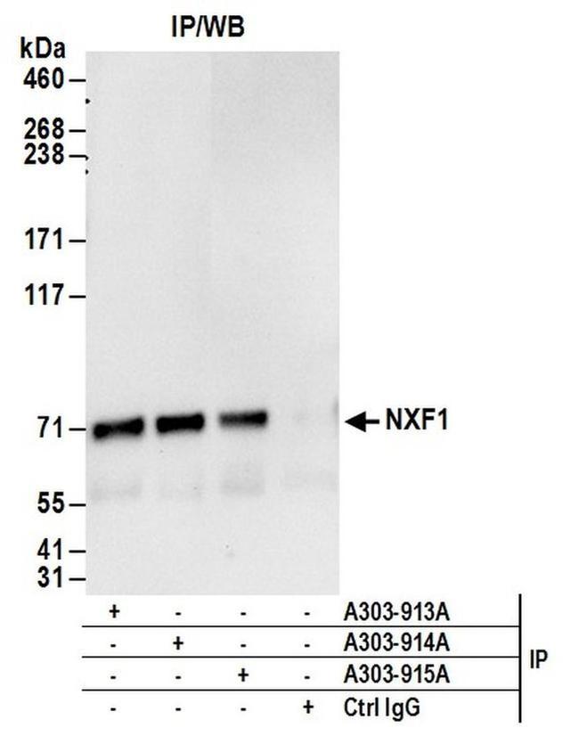 NXF1 Antibody in Western Blot (WB)