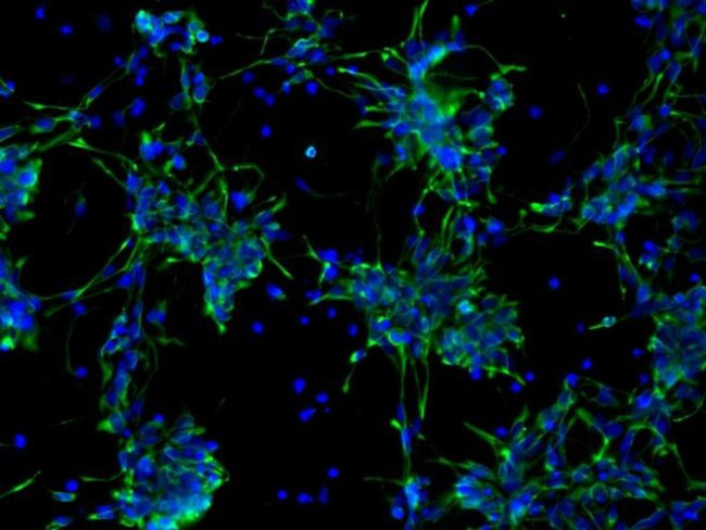 Nestin Antibody in Immunocytochemistry (ICC/IF)