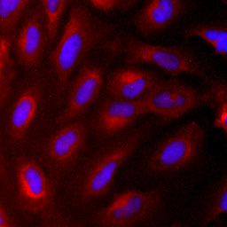 Nestin Antibody in Immunocytochemistry (ICC/IF)