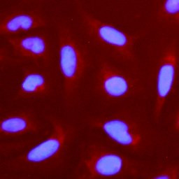 Nestin Antibody in Immunocytochemistry (ICC/IF)