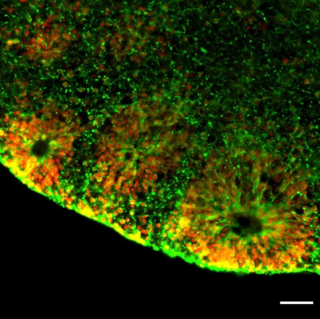 Nestin Antibody in Immunohistochemistry (Frozen) (IHC (F))