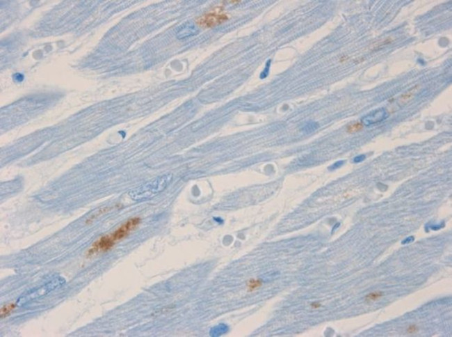 NF-H Antibody in Immunohistochemistry (Paraffin) (IHC (P))