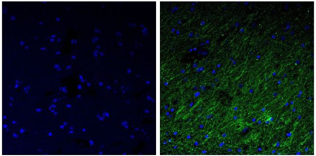 NEFH Antibody in Immunohistochemistry (Paraffin) (IHC (P))