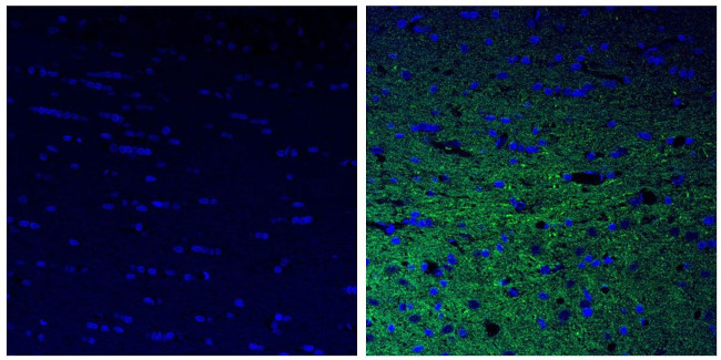 NEFH Antibody in Immunohistochemistry (Paraffin) (IHC (P))