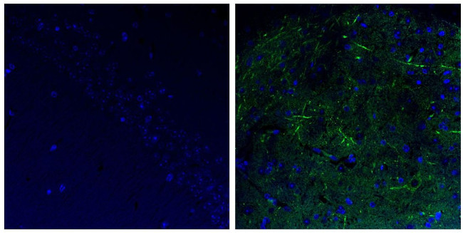 NEFH Antibody in Immunohistochemistry (Paraffin) (IHC (P))