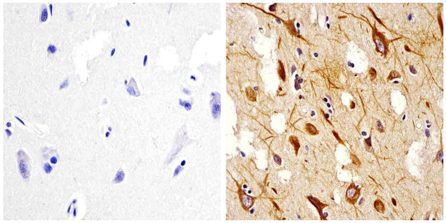 NEFH Antibody in Immunohistochemistry (Paraffin) (IHC (P))