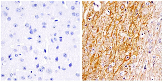 NEFH Antibody in Immunohistochemistry (Paraffin) (IHC (P))