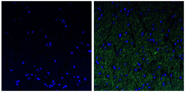 NEFL Antibody in Immunohistochemistry (Paraffin) (IHC (P))