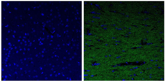 NEFL Antibody in Immunohistochemistry (Paraffin) (IHC (P))