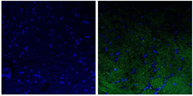 NEFL Antibody in Immunohistochemistry (Paraffin) (IHC (P))