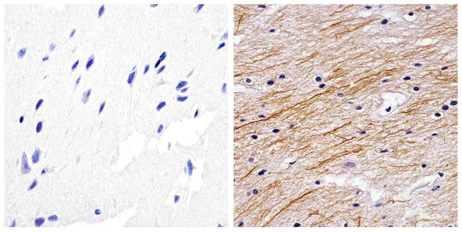 NEFL Antibody in Immunohistochemistry (Paraffin) (IHC (P))