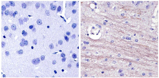 NEFL Antibody in Immunohistochemistry (Paraffin) (IHC (P))