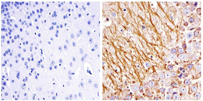 NEFL Antibody in Immunohistochemistry (Paraffin) (IHC (P))