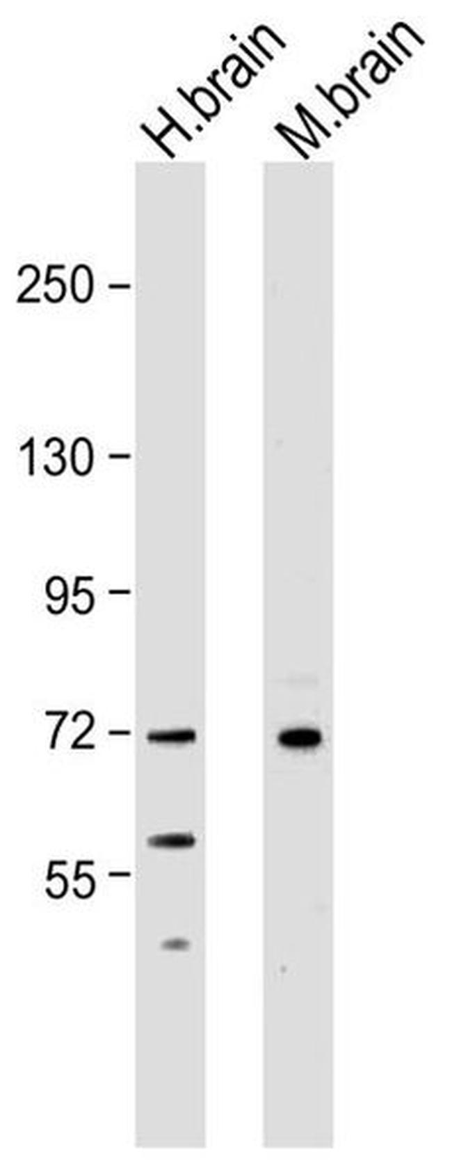 NEFL Antibody in Western Blot (WB)