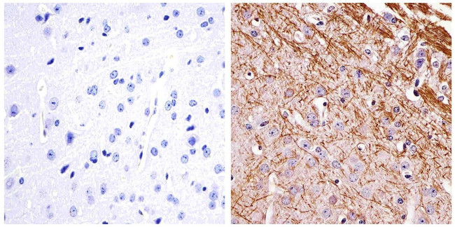 NEFL Antibody in Immunohistochemistry (Paraffin) (IHC (P))