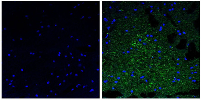 NEFM Antibody in Immunohistochemistry (Paraffin) (IHC (P))