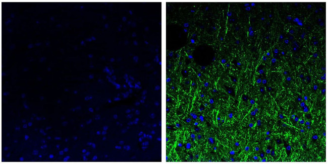 NEFM Antibody in Immunohistochemistry (Paraffin) (IHC (P))