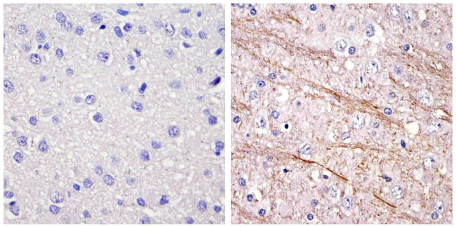 NEFM Antibody in Immunohistochemistry (Paraffin) (IHC (P))