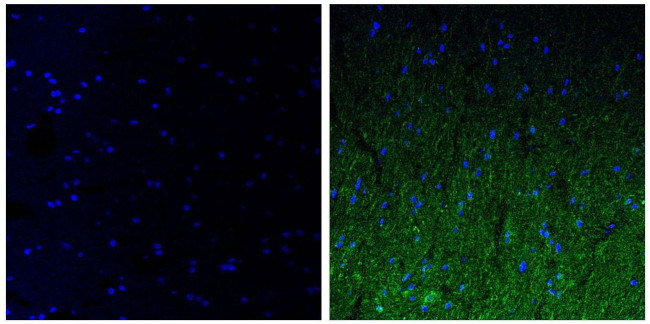 NEFM Antibody in Immunohistochemistry (Paraffin) (IHC (P))