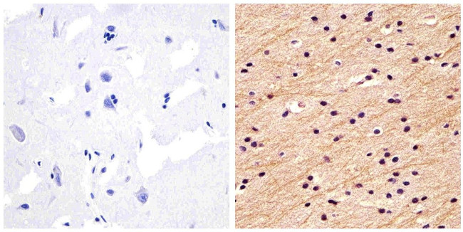 NEFM Antibody in Immunohistochemistry (Paraffin) (IHC (P))