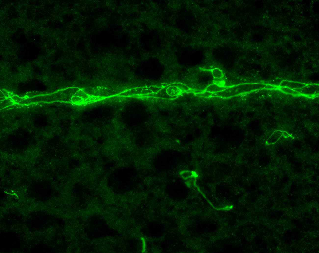 ZO-1 Antibody in Immunohistochemistry (IHC)