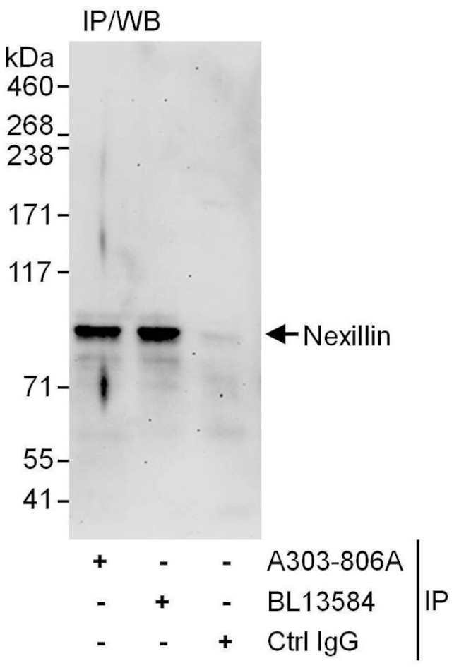 Nexilin Antibody in Immunoprecipitation (IP)