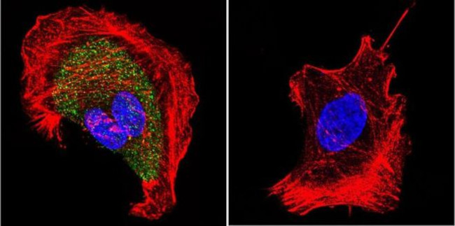 CHRNA1 Antibody in Immunocytochemistry (ICC/IF)