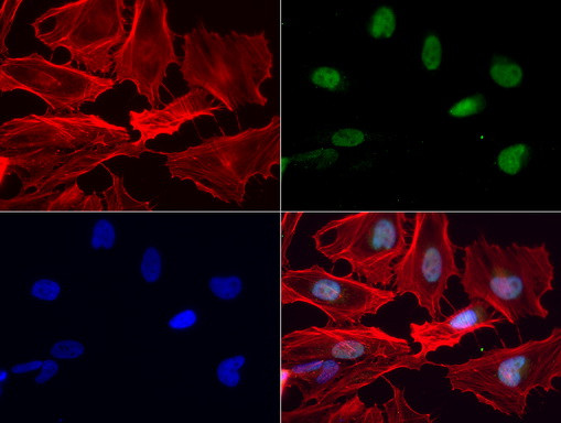 Nkx3.1 Antibody in Immunocytochemistry (ICC/IF)