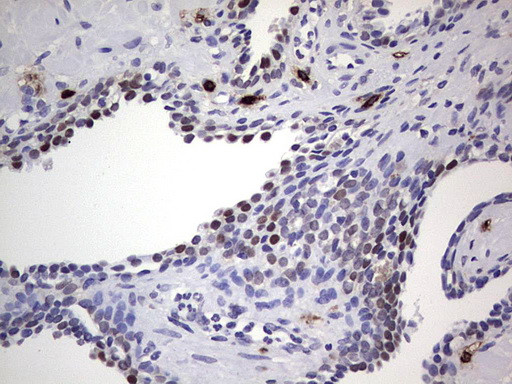 NKX3.1 Antibody in Immunohistochemistry (Paraffin) (IHC (P))