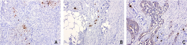 Nkx3.1 Antibody in Immunohistochemistry (Paraffin) (IHC (P))