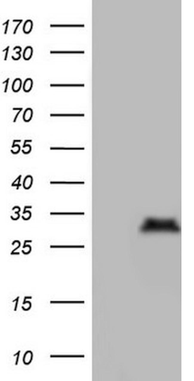 Nkx3.1 Antibody in Western Blot (WB)