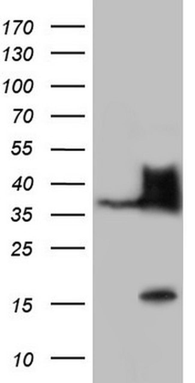 NKX3.1 Antibody in Western Blot (WB)