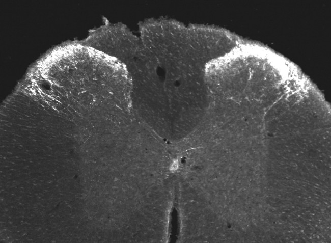 Nociceptin Antibody in Immunocytochemistry (ICC/IF)